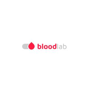 Wyniki badań tarczycy jak czytać – Spersonalizowana interpretacja wyników badań – Bloodlab